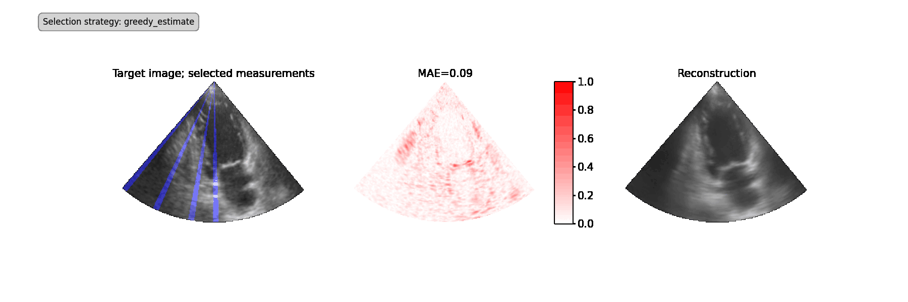 Ultrasound Line-Scanning Agent